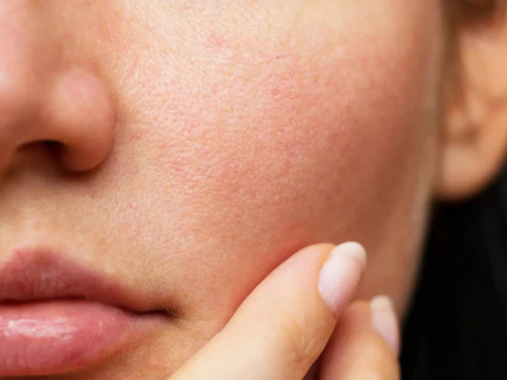 emotionskincare_huidbarriere